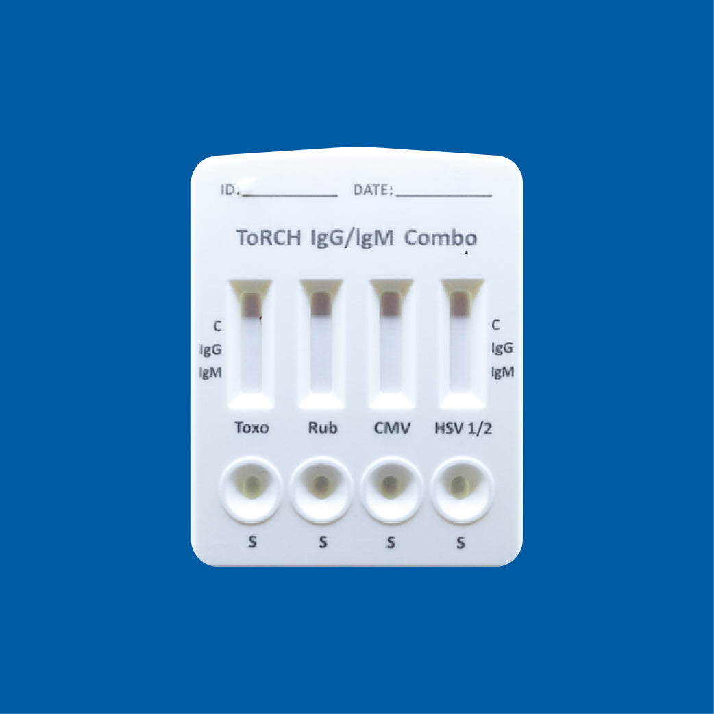 Prueba rápida de TORCH IgG e IgM